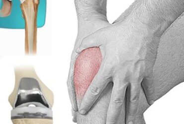 Joint Replacement Surgery in Krishnanagar
